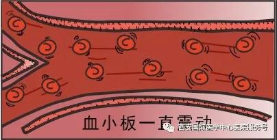 血小板是正常值的三倍？專家提醒小心血栓和出血！