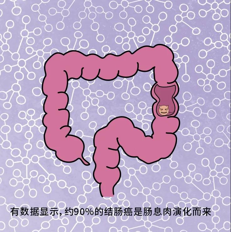 奪走“黑豹”生命的結(jié)腸癌，到底什么來頭？