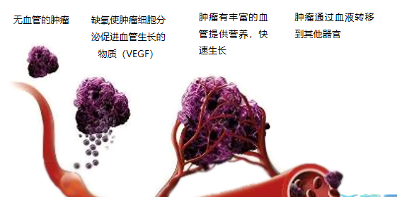 晚期腫瘤為什么會復(fù)發(fā)轉(zhuǎn)移？