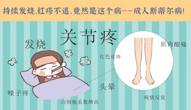 持續(xù)發(fā)燒、紅疹不退……她終于在這里治好了這個(gè)罕見病