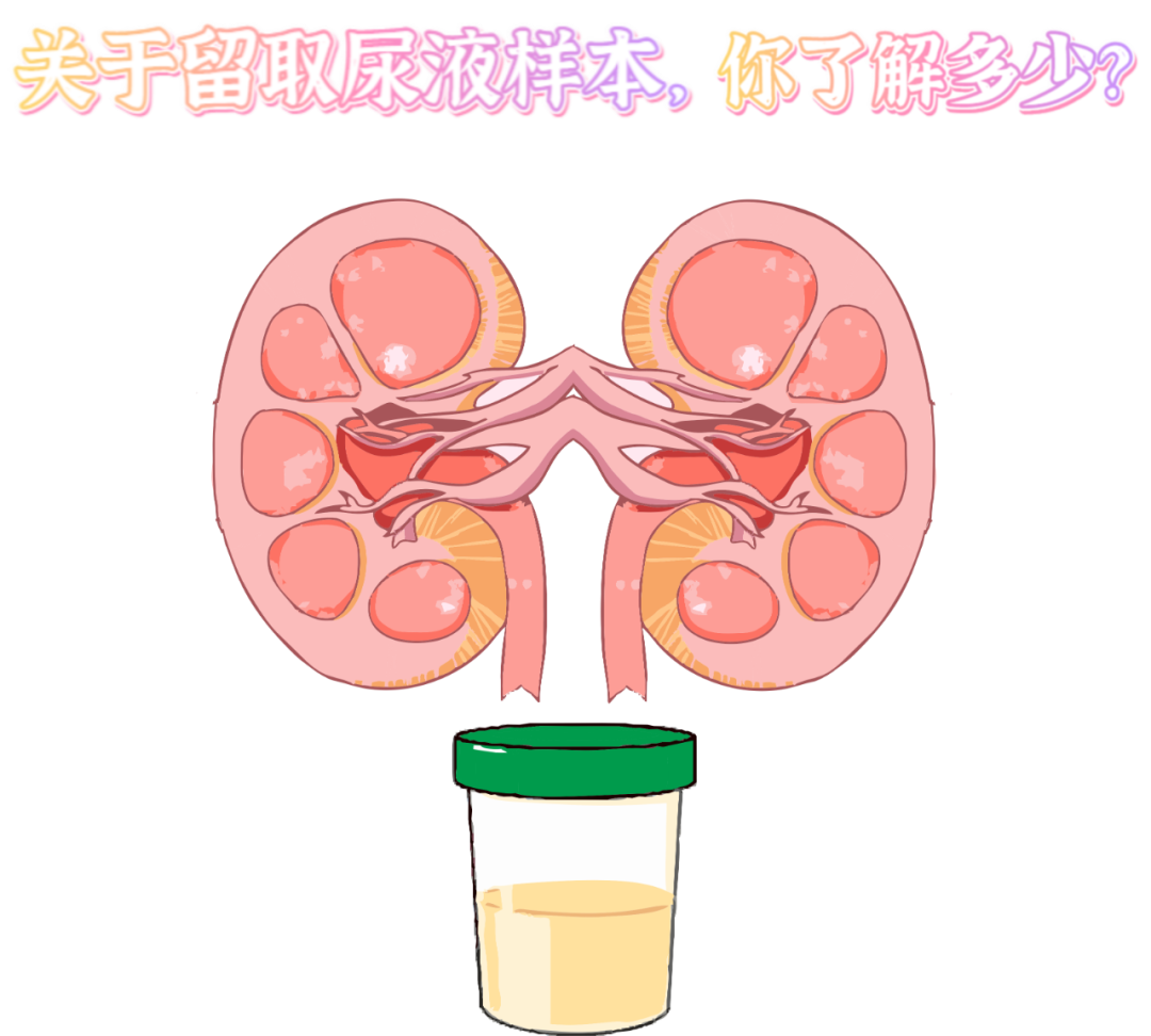 做尿檢，不得不說的注意事項(xiàng)！