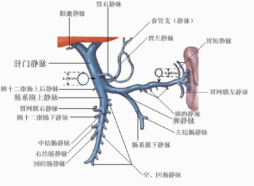 反復嘔血、黑便怎么辦？TIPS手術能解決