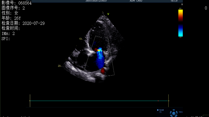 心電圖異常，心臟卻沒(méi)事，罪魁禍?zhǔn)资恰?>
				             </a>
                <div   id=