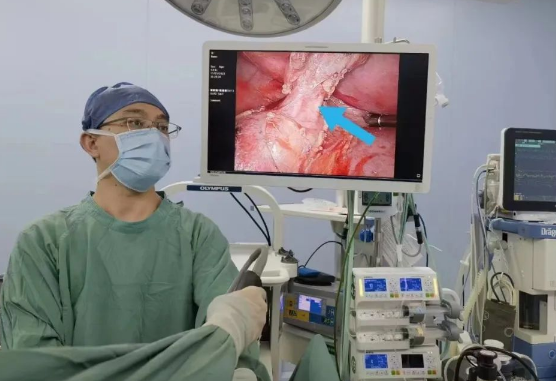 30歲小伙持續(xù)發(fā)燒咳嗽，原來是多長一塊肺......