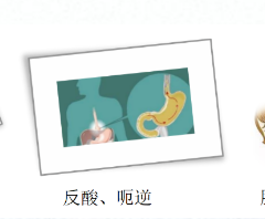 關(guān)愛(ài)身體健康，輕松檢查胃腸