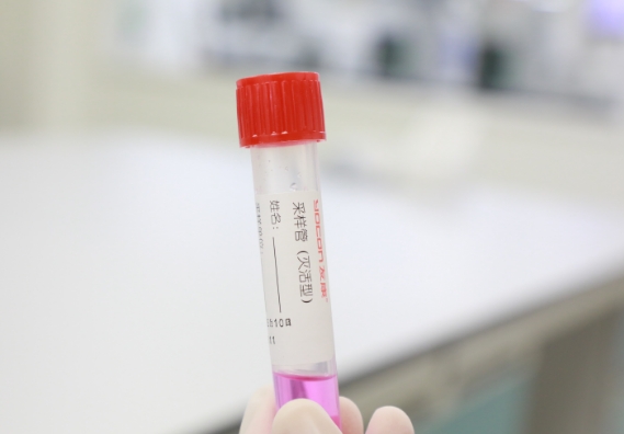 支原體感染檢測手段知多少？