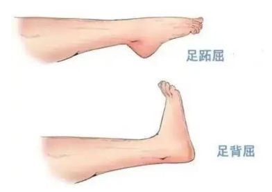 扭胯小連步、動(dòng)感搖花手……“科目三”雖火，運(yùn)動(dòng)損傷也要防！