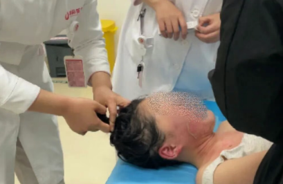 14歲，面、頸、胸燙傷，只因中午那鍋面湯…